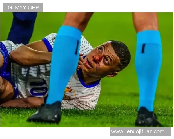 足球球星鼻骨受伤引发关注专家解析运动损伤防护要点 足球球星鼻骨受伤引发关注专家解析运动损伤防护要点